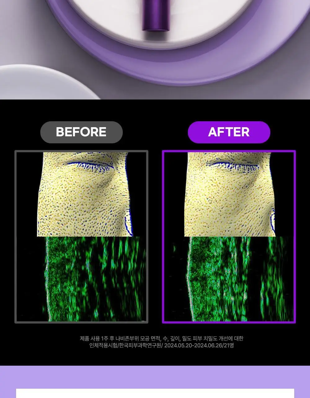 [단독기획/PDRN] 파티온 노스카나인 트러블 모공탄력 크림 45ml 기획(+15ml) 상세페이지 4